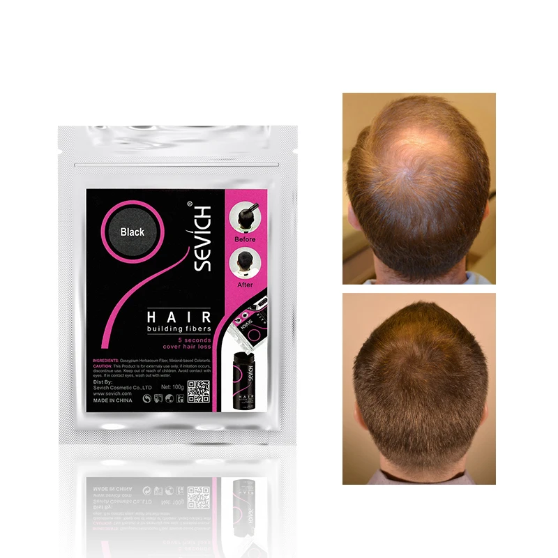 Sevich 100g 10 Color Keratin Hair Loss Building Fiber Hair Growth Fiber Refill Hair Loss Concealer Blender 50g Hair Care Product - Image 3