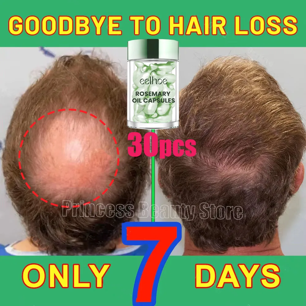 Hair Growth Products Anti Hair Loss Essential Oil Prevent Baldness Scalp Treatment Capsule Fast Regrowth Beauty Health Men Women - Image 3